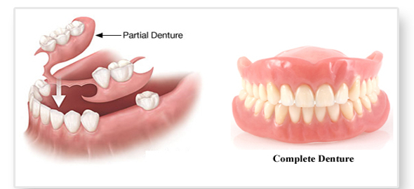 Προσθετική Οδοντιατρική
